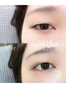 ディレット(DILETTO)/ラッシュリフト