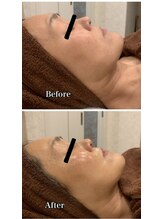 ブランシュール/エンビロンフルコース 