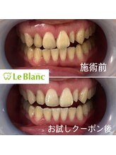 ルブラン 奈良店(Le Blanc)/お試しで効果実感！