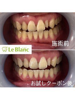 ルブラン 奈良店(Le Blanc)/お試しで効果実感！