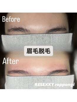 リゼクシー INTERNATIONAL麻布十番 六本木(RESEXXY)/