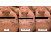 ディサイドロー(DECIDE L.A.W)/継続する度変化が楽しい！