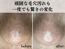 エアル(earu.)