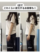 チャンス 西院(chance)/反り腰/小顔/腰痛/頭痛/猫背