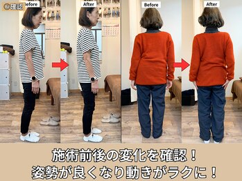 東林間整骨院/施術後の体の変化の確認