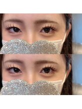 ビビ(VIVI)/バインドロック１００束