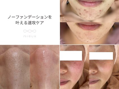 ミュー 栄本店(mieux)の写真
