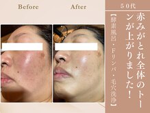 ケムズ インプルーブメントサロン(KMS IMPROVEMENT salon)/