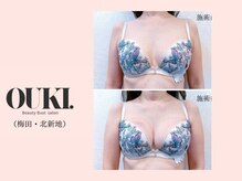 オウキ 梅田北新地(OUKI.)/バストアップ結果写真