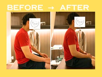 こころ整骨院/30代男性のビフォーアフター