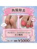 かかと角質除去 ★1日1人限定★モニター価格!ワンカラー/ラメグラ