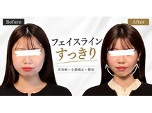 ハリユナイテッド 原宿鍼灸 整体院(HALI UNITED)