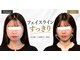 ハリユナイテッド 原宿鍼灸 整体院(HALI UNITED)の写真