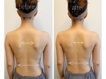 パル コルギサロン(Pal. Korugi salon)/コルギビフォーアフター