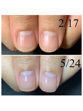 アマランサス(Amaranthus)/自分の爪が縦長で美爪に♪