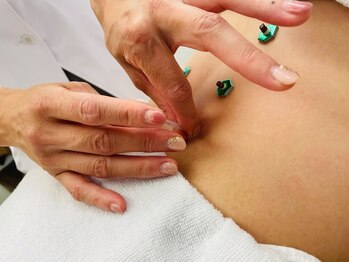 AZ美 整体院/鍼灸師の国家資格保持者の施術