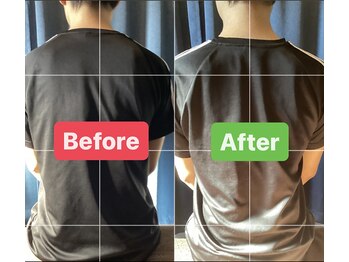 松 中目黒/30代男性 首肩こり、腰痛 改善例