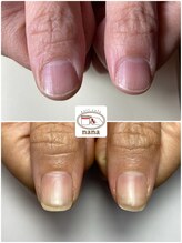 ネイルカフェ ナナ(nailcafe'nana)/自爪育成矯正