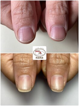 ネイルカフェ ナナ(nailcafe'nana)/自爪育成矯正