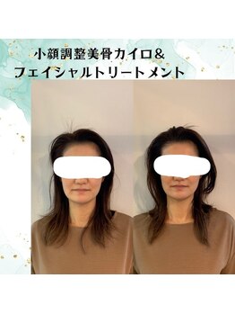 るりはな/小顔2