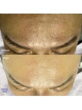 マリーブ 恵比寿本店(MAREVE)/マリムーブフェイシャルワックス