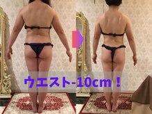 ビューティートリートメント ミニョン