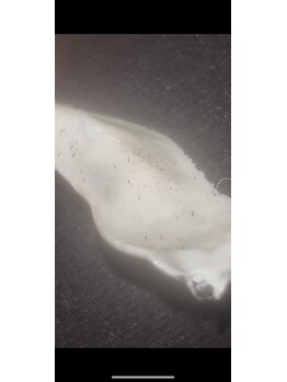 エルール トータルビューティ(Aileure total beauty)/Waxフェイシャル 毛穴掃除