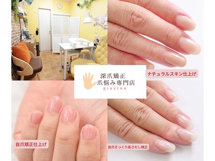 グレースレディの写真