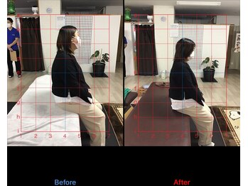 ストレチックス 近江八幡店/マタニティ整体 腰痛・姿勢改善