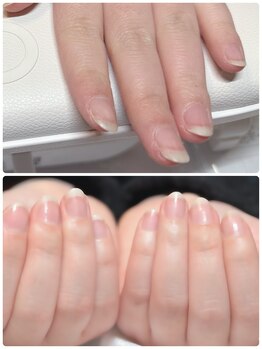 ラブユー(LvU)/ネイルケア