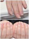 ネイルケア