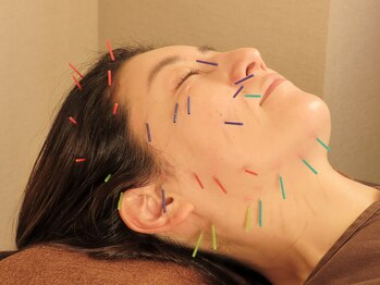 ベル(BELLE)の写真/《美容鍼をやってみたい方へ》初めてでも気軽にお試し出来るコースのご用意あり!様々なお顔のお悩み改善♪