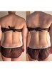 【9時半~14時】ハイパーナイフ全身+上半身or下半身リンパ ¥16500→¥14500