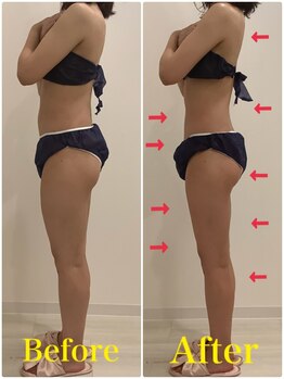 スペチアーレ 夙川/浮腫みをとって痩せ体質に!