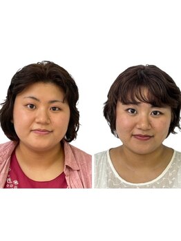 小顔になりたい