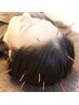 【ひどい頭痛・肩こりでお悩みの方へ～】　頭痛専門鍼灸　7000円⇒4980円