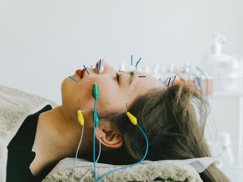 アキュネ 福岡薬院店(acune)/福岡/薬院/美容鍼/美肌