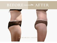 ママリスサロン(Mamariss Salon)/【痩身 10回 】