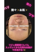 ナナラ(NANALA)/ツヤ、ハリ、弾力☆たるみケア