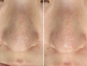 リッチ(Rich+)/白玉ワックス