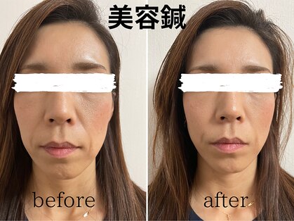 栖の写真