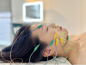 サロンドベベ(salon de Bebe.)の写真/【烏丸御池／結果重視ならBebe式美容鍼】最多箇所への低周波電気で効果に特化！