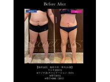 ミモサ 川中島温泉テルメDOME内(mimosa)/