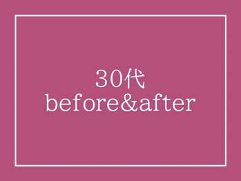 アクアビー(AQUA-B)/