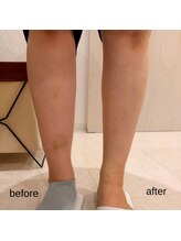 ファロンビューティー(fallon beauty)/お客様ビフォー×アフター