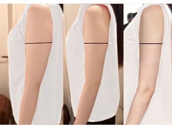 スリーバランス(3balance)の写真/3回で脂肪率5％減！"痩せたい & 綺麗になりたい方"へ！脂肪を分解して贅肉を減らします！