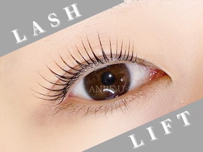 アンビーユー(ANBE.U)の写真