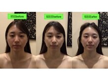 アジール 長岡リバーサイド千秋店(agir)/before/after画像