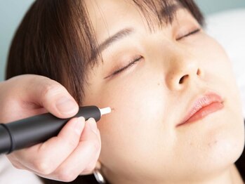 ココア(COCOA)の写真/【ポイントシミケア＆プラズマフェイシャル モニター様募集中☆】肌質改善に◎ぜひ一度お試しください♪