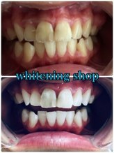 ホワイトニングショップ 池袋店/歯科医師提携積ホワイトニング